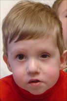 Caden's Eye - Horner Syndrome June 2006